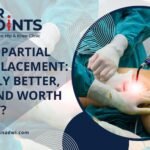 Robotic Partial Knee Replacement: Is It Truly Better, Safer, and Worth the Cost?